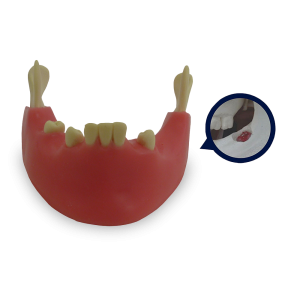 MANDÍBULA COM 3º MOLAR INCLUSO E GENGIVA - cód. 4401G-02