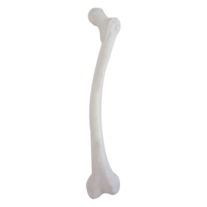 FÊMUR COM DEFORMIDADE MEDIAL VALGO -  ESQUERDO - cód. 2025 DMVL