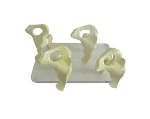 KIT DE QUADRIL COM OSTEOARTRITE (4 PEÇAS) - cód. 9598